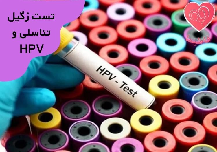 تست زیگیل تناسلی یا HPV