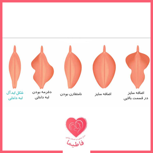 آناتومی واژن + واژن زن چند سوراخ دارد؟